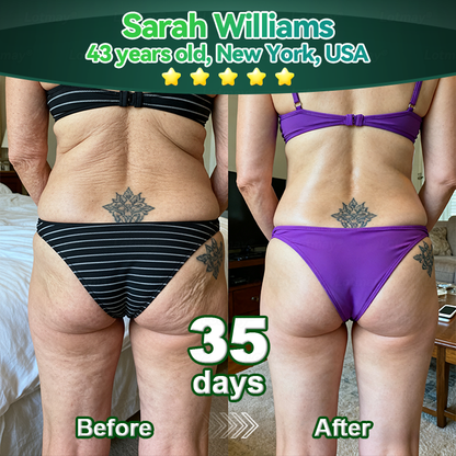 🎄🇬🇧 𝐂𝐡𝐫𝐢𝐬𝐭𝐦𝐚𝐬 𝐅𝐥𝐚𝐬𝐡 𝐒𝐚𝐥𝐞 – 𝟖𝟎% 𝐎𝐅𝐅 𝐓𝐨𝐝𝐚𝐲 𝐎𝐧𝐥𝐲! 🎁🌿 𝐂𝐫𝐨𝐚𝐢𝐞®  𝐒𝐭𝐞𝐦 𝐂𝐞𝐥𝐥 & 𝐂𝐨𝐥𝐥𝐚𝐠𝐞𝐧 𝐏𝐞𝐩𝐭𝐢𝐝𝐞 𝐎𝐫𝐚𝐥 𝐃𝐫𝐨𝐩𝐬 (𝐋𝐢𝐟𝐭 & 𝐅𝐢𝐫𝐦 𝐒𝐚𝐠𝐠𝐢𝐧𝐠 𝐒𝐤𝐢𝐧 & 𝐑𝐞𝐝𝐮𝐜𝐞 𝐖𝐫𝐢𝐧𝐤𝐥𝐞 𝐅𝐨𝐫𝐦𝐚𝐭𝐢𝐨𝐧)