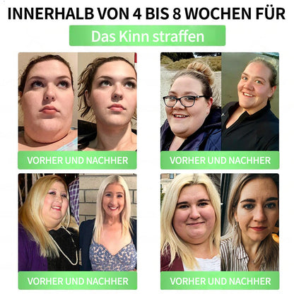 🇩🇪Berlin Health®  𝗚𝗟𝗣-𝟭 𝟖-𝗶𝗻-𝟭 Gesundheitslösung zum Einnehmen (nur einmal täglich. sichtbare Veränderungen in 7 Tagen) ✅ Bei Fettleibigkeit. Herz-Kreislauf-Gesundheit. Diabetes. Schlafapnoe. Darmgesundheit. Gelenkproblemen und mehr