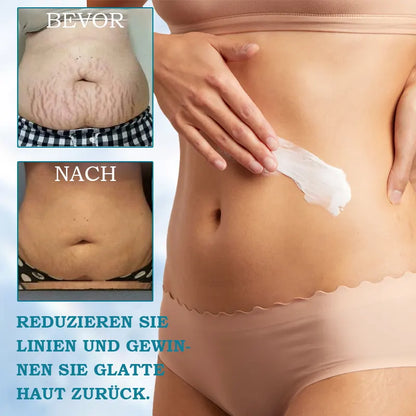 | Letzter Tag – 𝟕𝟓 % 𝐑𝐚𝐛𝐚𝐭𝐭 | 💓🇩🇪 - 𝐅𝐮𝐛𝐬𝐭𝐚® 𝐅𝐨𝐫𝐭𝐬𝐜𝐡𝐫𝐢𝐭𝐭𝐥𝐢𝐜𝐡𝐞 𝐒𝐭𝐫𝐚𝐟𝐟𝐞𝐧𝐝𝐞 & 𝐅𝐚𝐥𝐭𝐞𝐧𝐫𝐞𝐝𝐮𝐳𝐢𝐞𝐫𝐞𝐧𝐝𝐞 𝐂𝐫𝐞𝐦𝐞: Stellt die Hautelastizität wieder her☘️