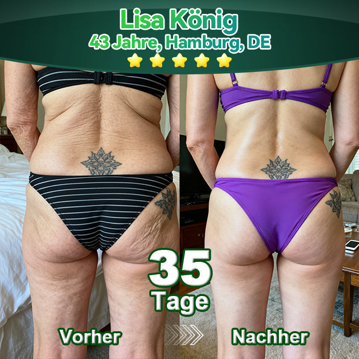 Offiziell autorisierte Exklusivausgabe | Lotmay® Stammzell-Kollagenpeptid Oraltropfen👩‍⚕️(Straffung & Glättung der Haut & Verringerung der Faltenbildung)🌵