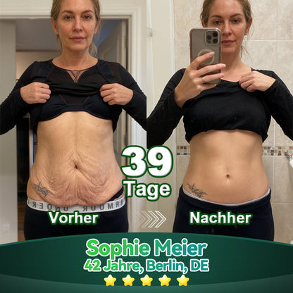 Offiziell autorisierte Exklusivausgabe | Lotmay® Stammzell-Kollagenpeptid Oraltropfen👩‍⚕️(Straffung & Glättung der Haut & Verringerung der Faltenbildung)🌵