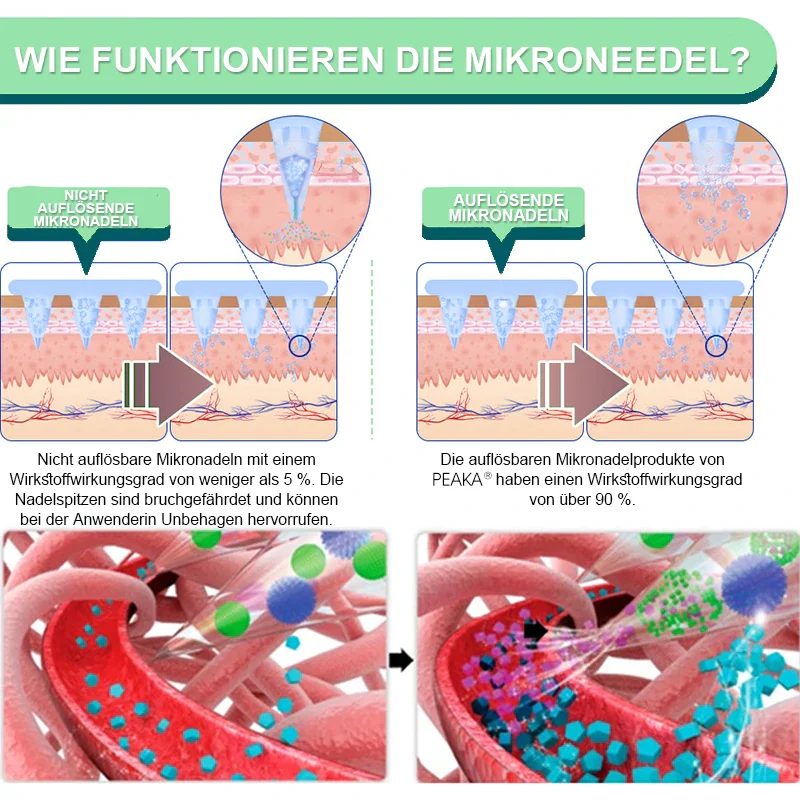 【Letzter Tag – 60 % RABATT 🏅】PEAKA® NIDDK-Tirzepatid Schlankheits- & Gesundheits-NANO-MIKRONEDEL-PFLASTER 🇩🇪 (Kein Schmerz, 24/7 Wirkstofffreisetzung | Schnell 9 kg verlieren | 90 % Blutzuckersenkung) 🌞